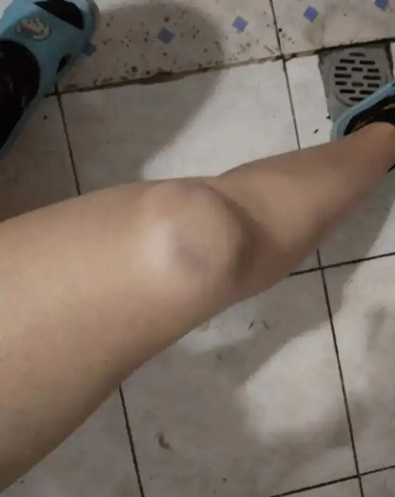 溜冰摔成这样,我还有救吗网友先发个朋友圈哈哈哈哈哈哈