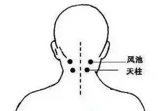 颈椎病有多要命颈椎不好的人一定要看