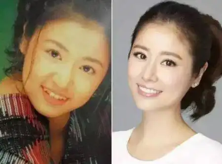 整牙整容动辄上万的整牙为什么会这么火