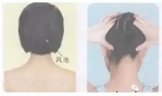 地铁膏药姐,引发全民热议低头族颈椎的健康问题