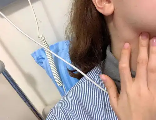 女人脖子长包,诊断鼻咽癌晚期,坚持33次化疗有信心不放弃