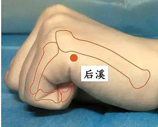 养生文化颈椎有问题,5个开关来帮忙