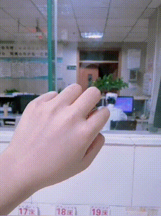 有点慌,溜冰摔的膝盖鼓起这么一个大包,专业团队可以抬走了哈哈哈
