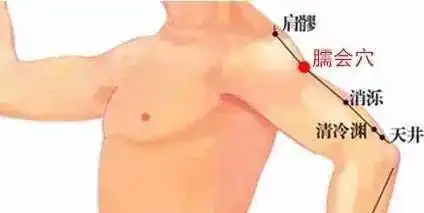 治疗落枕肩周炎,艾灸效果立竿见影太实用了,收起来先