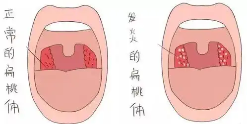 宝宝频繁生病,只会干着急学会这几招,提高免疫力