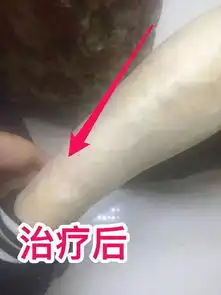 老倪膏药各部位症状及的贴敷方法