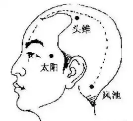 各种来历不明的头痛终于有办法搞定了各个击破,火速收藏
