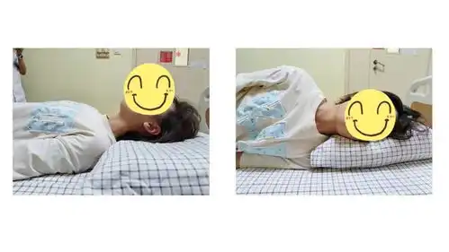 健康科普落枕知多少预防与治疗全攻略请查收