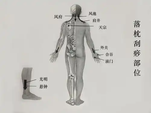 颈椎病落枕刮一刮这几个部位