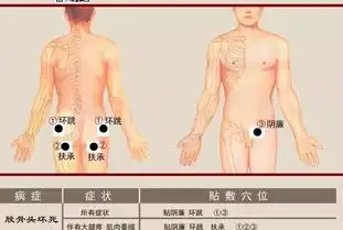 膏药贴敷位置