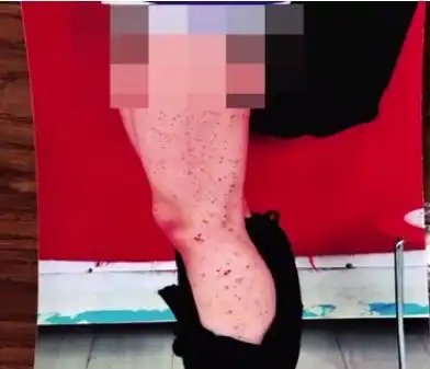 校园惊现容嬷嬷女高中生腿上全是血点知道原因后网友惊呆