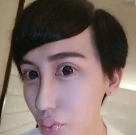 向太因心梗住院急救,脱险后晒自拍成蛇精脸,网友留言太搞笑