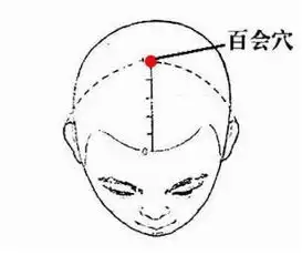 百会穴针灸穴位搜狗百科
