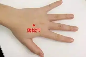 落枕怎么办怎么快速治疗落枕