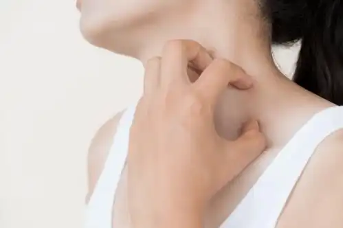 颈部有包块千万别大意一