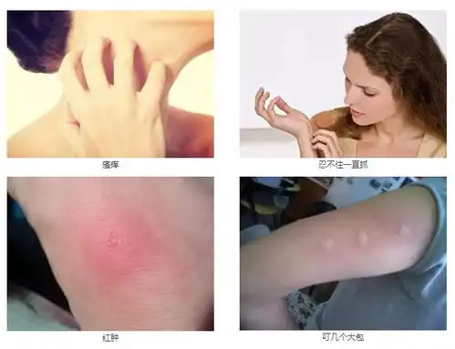 这只泰国进口平价驱蚊水,7小时防蚊轻轻一喷,无忧度夏